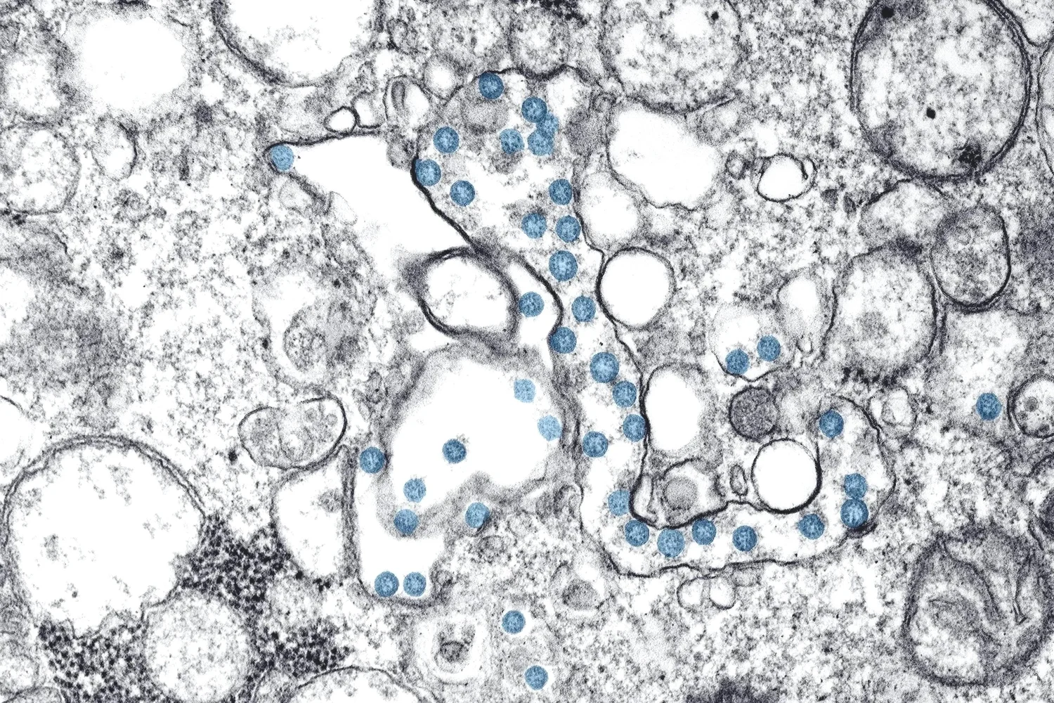 Pale blue and grey electron-microscope view of clustered viral particles.